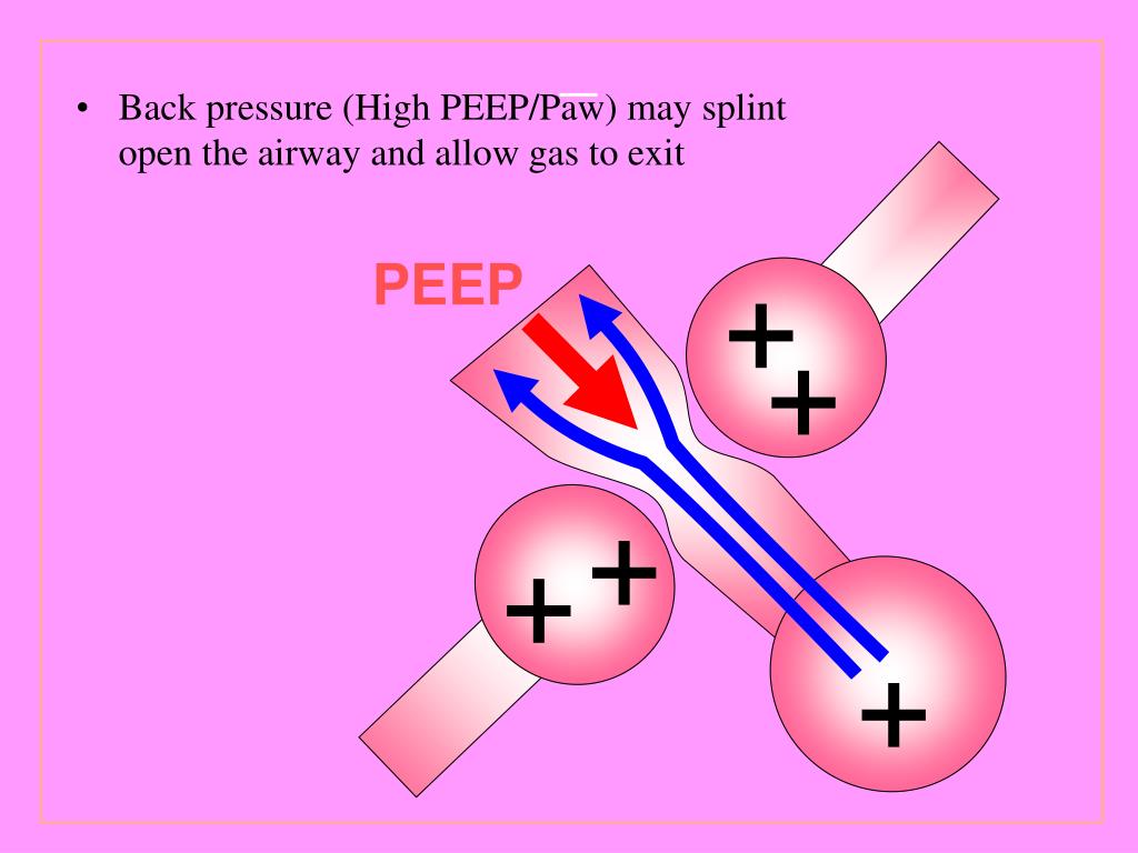 PPT Choice of Oscillator & Jet Ventilator (15 min) Choice of High