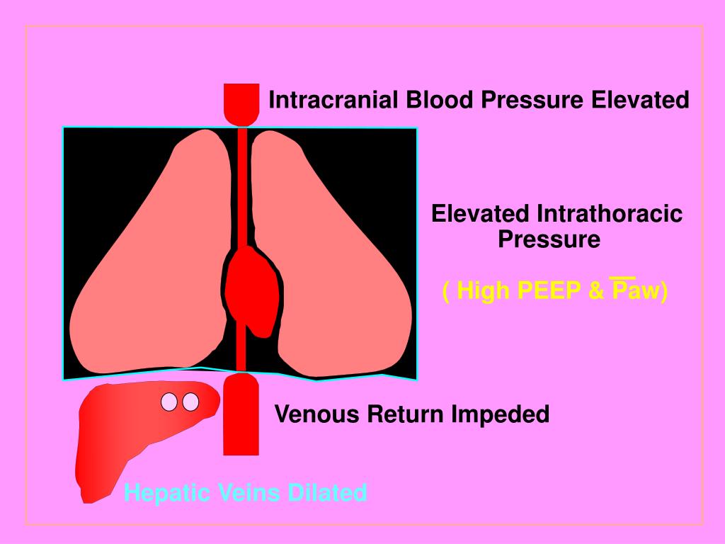 PPT Choice of Oscillator & Jet Ventilator (15 min) Choice of High