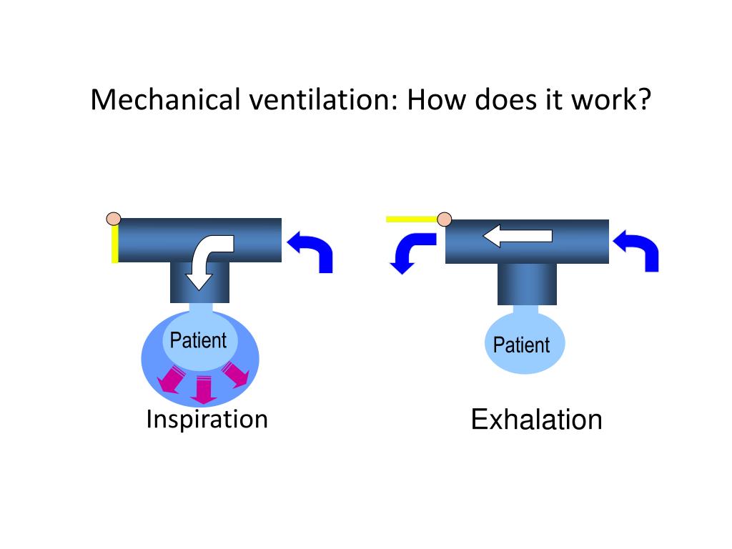 PPT Neonatal Mechanical Ventilation PowerPoint Presentation, free