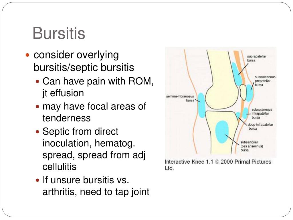 PPT Morning Report PowerPoint Presentation, free download ID564070