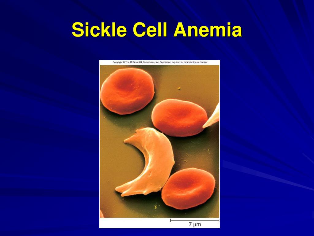 PPT The Cardiovascular System The Blood PowerPoint Presentation ID