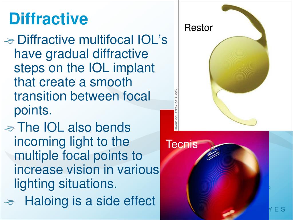 PPT Multifocal Intraocular Lenses & Contrast Sensitivity PowerPoint