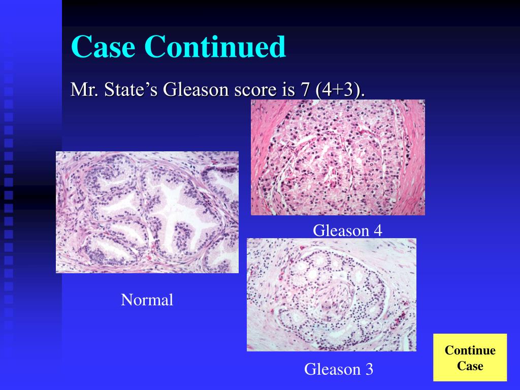 PPT Cancer Survivorship PowerPoint Presentation, free download ID58549