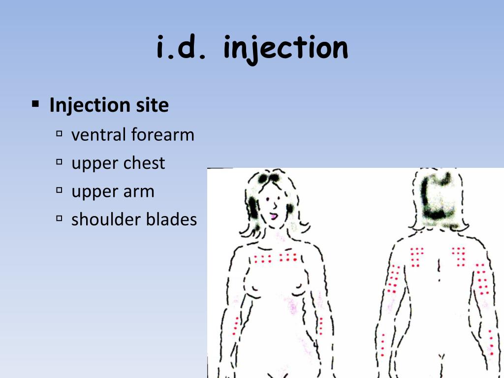 PPT Administering medication; s.c ., i.d . injections PowerPoint
