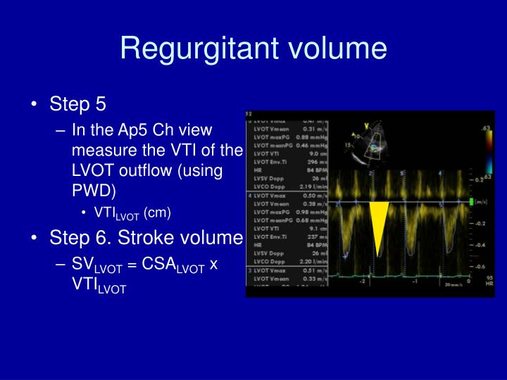PPT How to Diagnose and Assess Severity of Mitral Regurgitation by