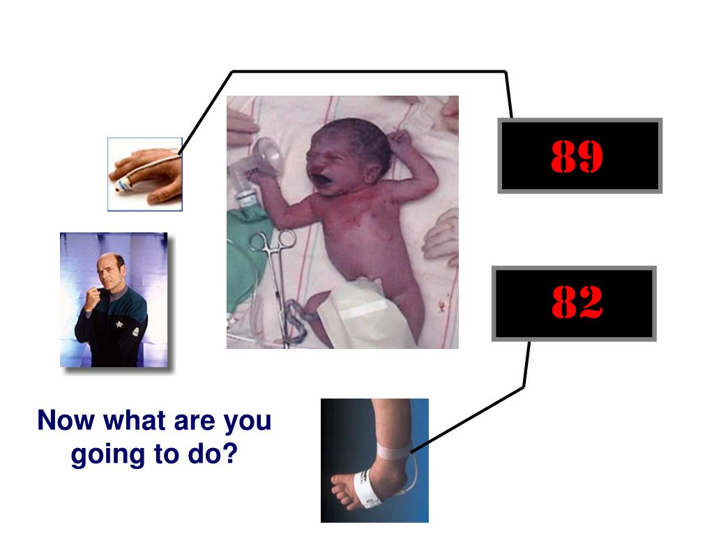 PPT Persistent Pulmonary Hypertension in the Newborn PowerPoint