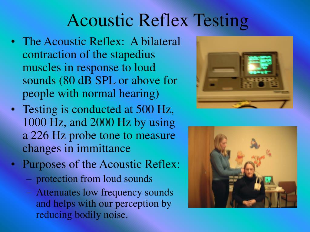 PPT Cranial Nerve Evaluation Acoustic Neuroma and the Facial Nerve