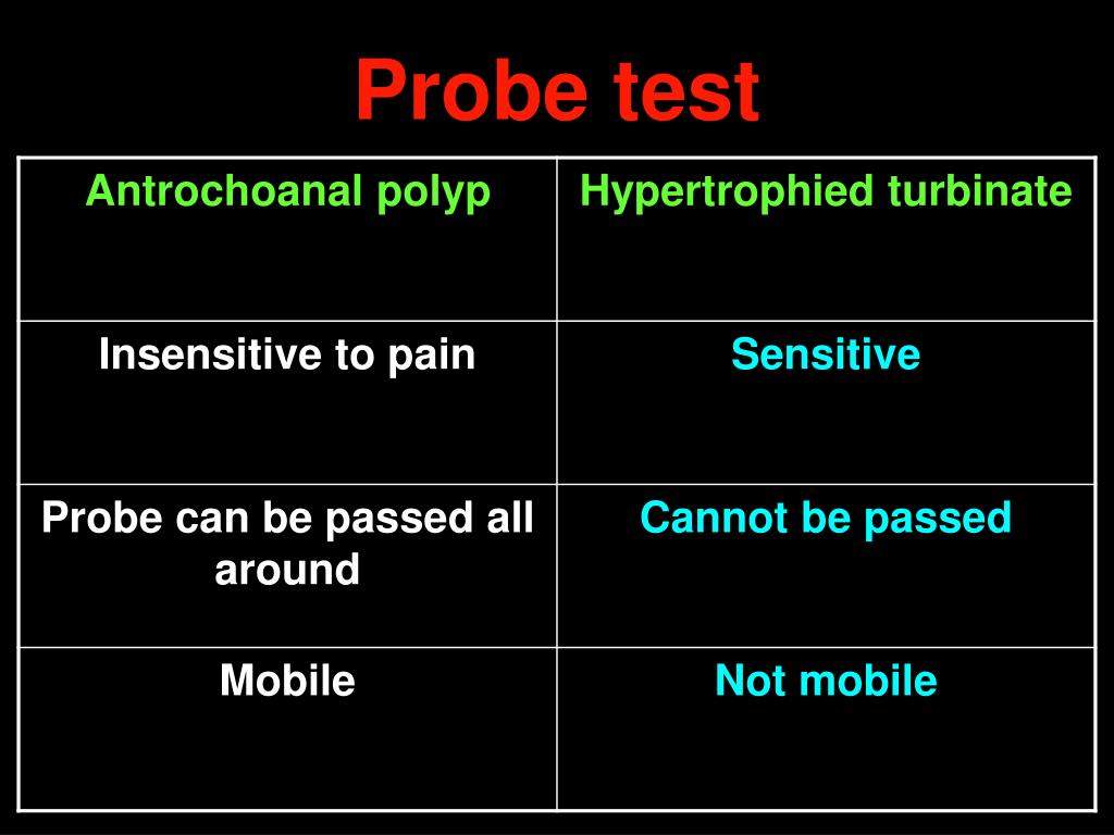 PPT Nasal Polyps PowerPoint Presentation ID602549
