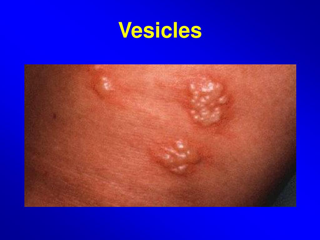 PPT Introduction to Dermatology PowerPoint Presentation, free