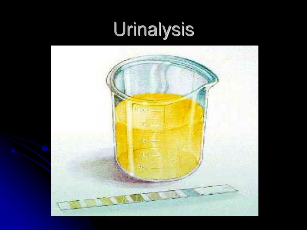 PPT Urinalysis and Personal Accountability PowerPoint Presentation