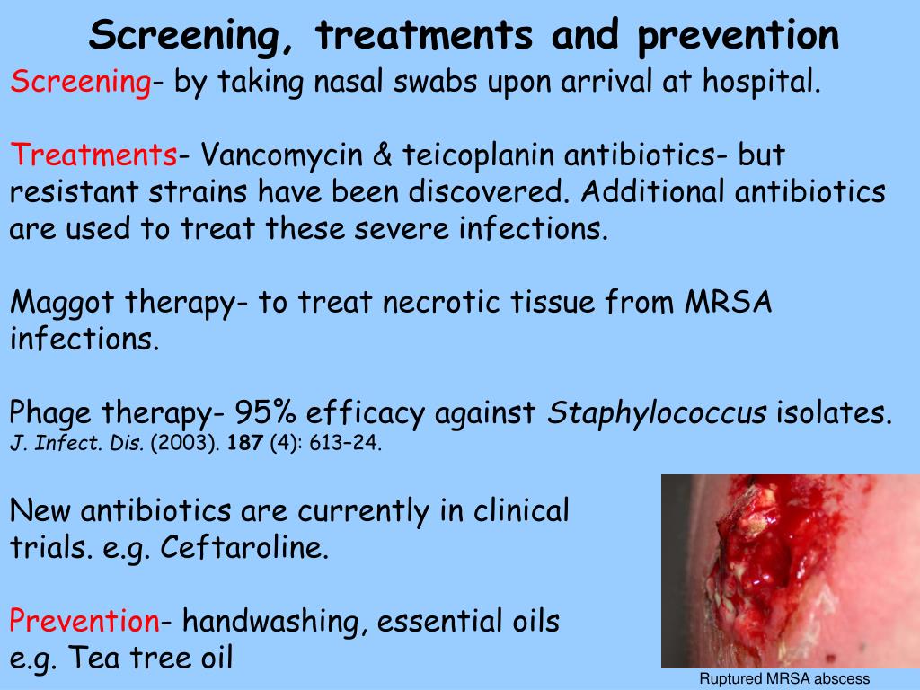 PPT Rapid and sensitive detection of MRSA by PCRbased methods in the environment and hospital