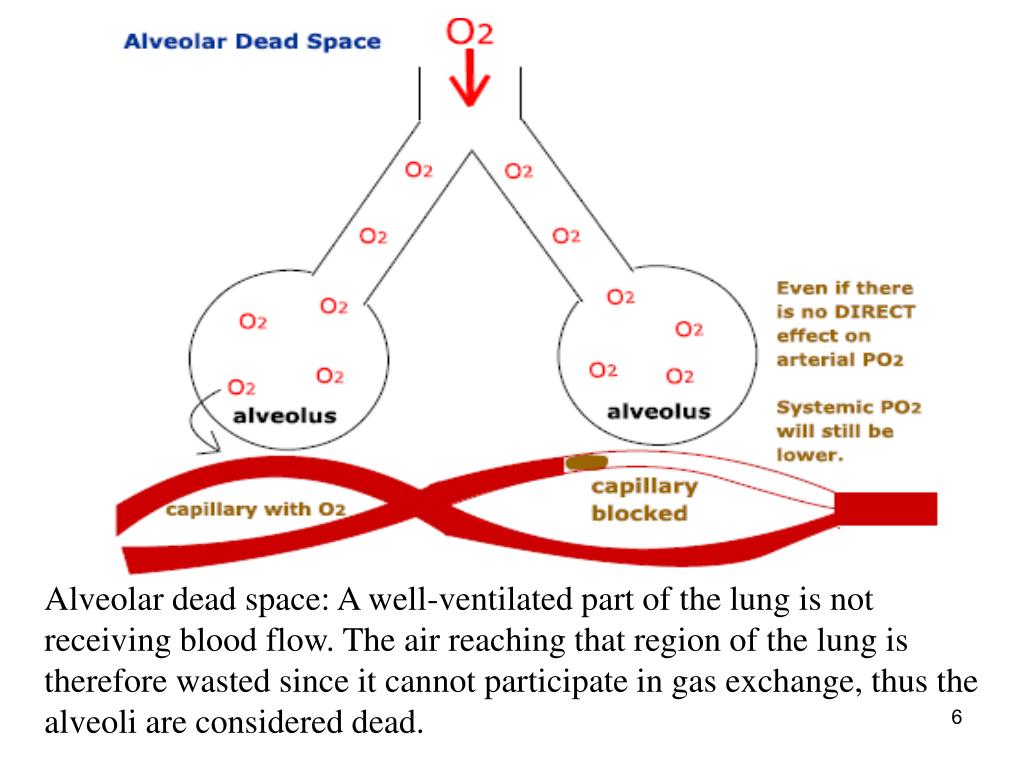 Volume alveolar dead space lvkmfk