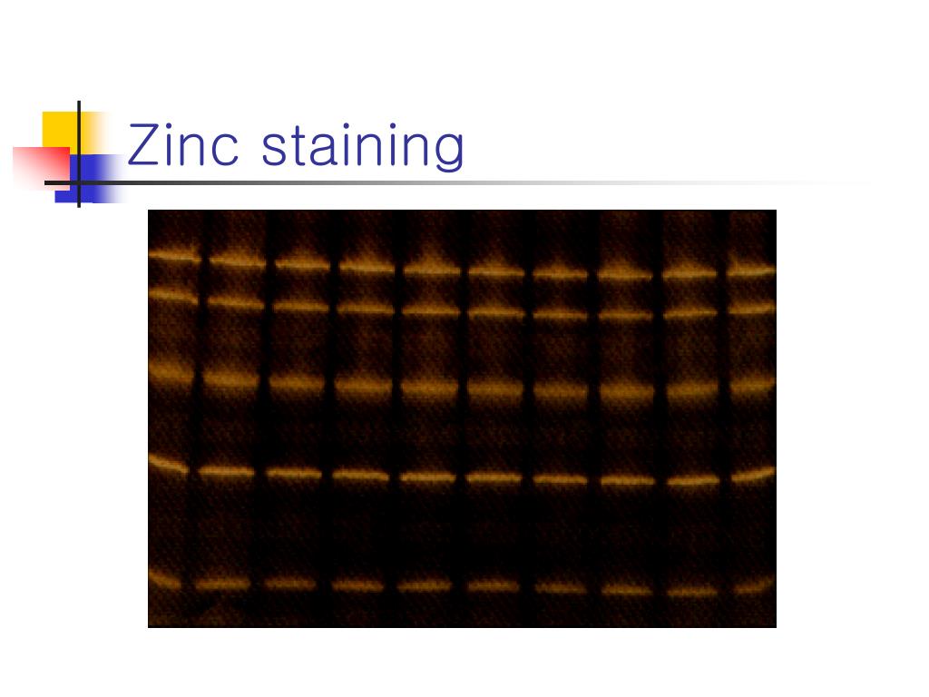 PPT Detecting proteins in polyacrylamide gels and on electroblot