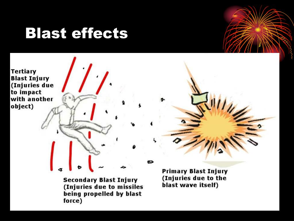 PPT Evaluation and Treatment of Blast Injuries PowerPoint