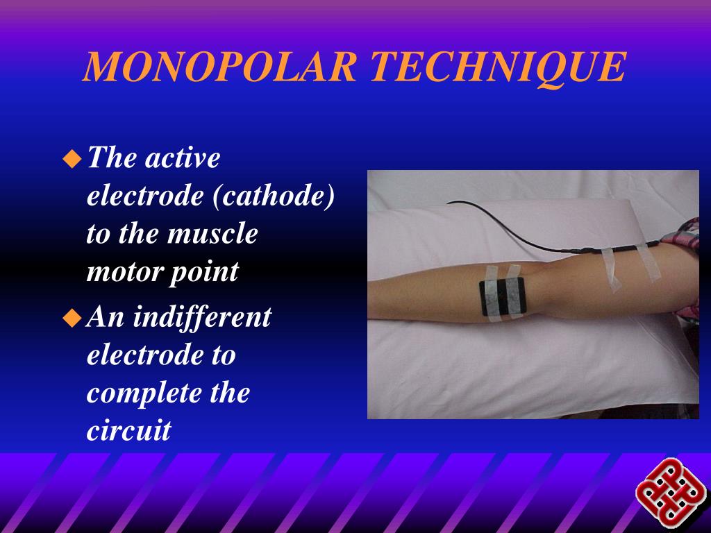 PPT PRINCIPLES OF THERAUPEUTIC CURRENTS AND NEUROMUSCULAR ELECTRICAL