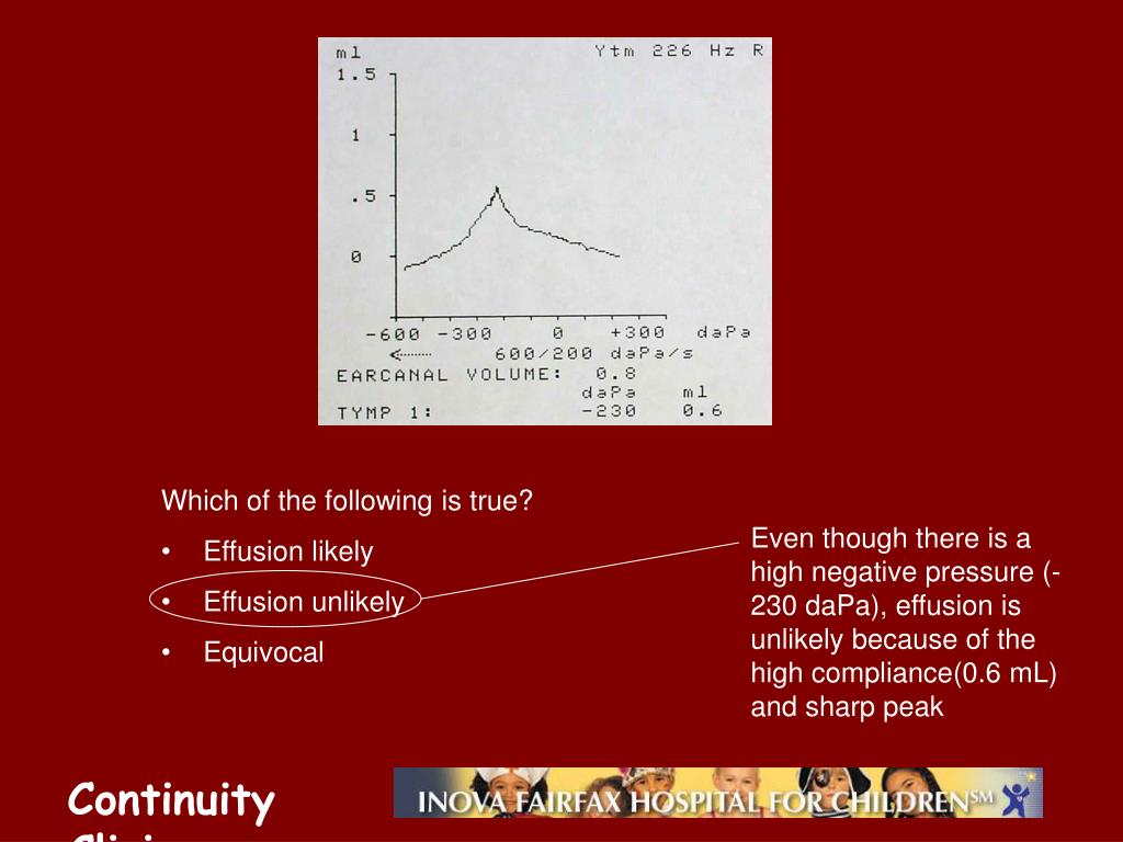PPT Tympanometry PowerPoint Presentation, free download ID647193