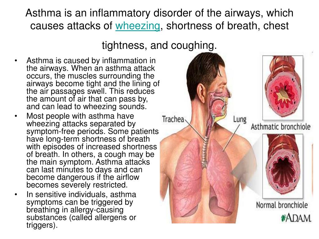 PPT Three main types of lung disease PowerPoint Presentation, free