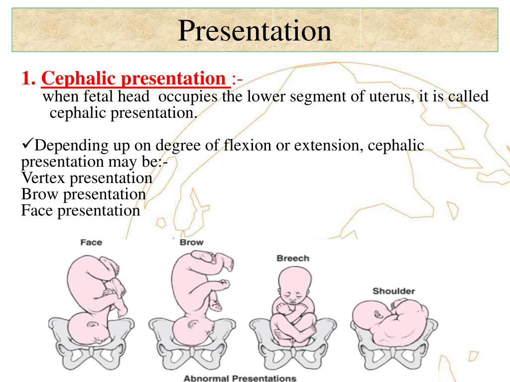 PPT Lie, Presentation, Position, Attitude and Denominator PowerPoint