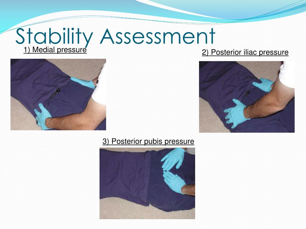 PPT Pelvic Immobilization Devices PowerPoint Presentation ID685321