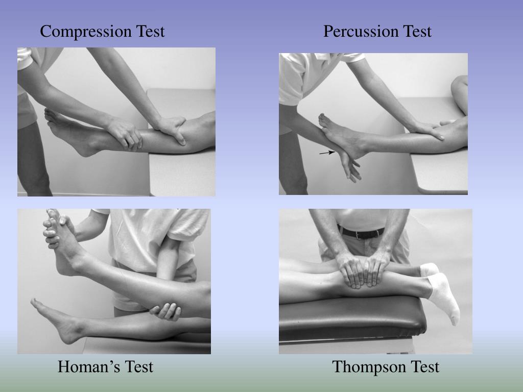 PPT Chapter 19 The Ankle and Lower Leg PowerPoint Presentation, free