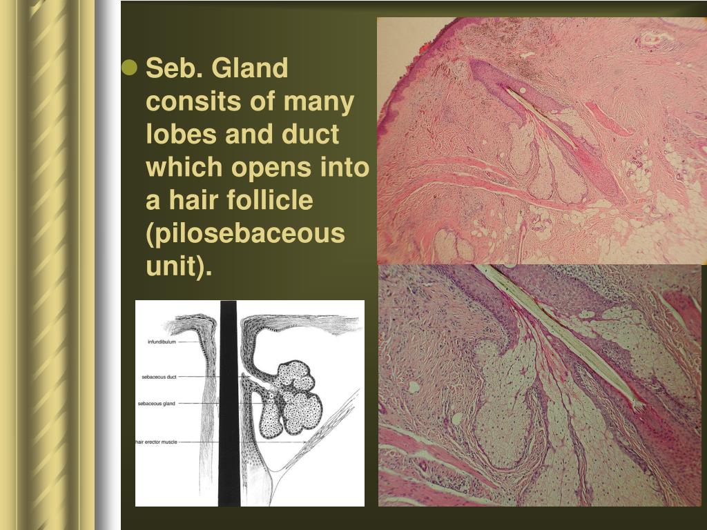 PPT Disorders of Sebaceous Glands PowerPoint Presentation ID694078