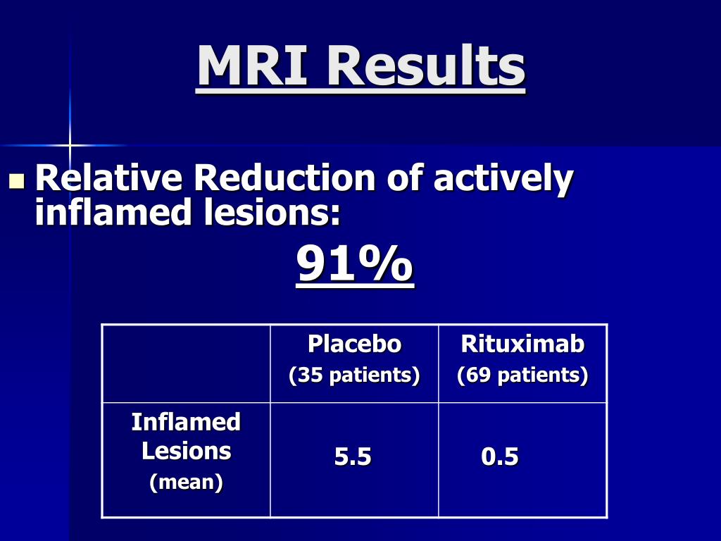 PPT Rituximab (RITUXAN) & Multiple Sclerosis PowerPoint Presentation