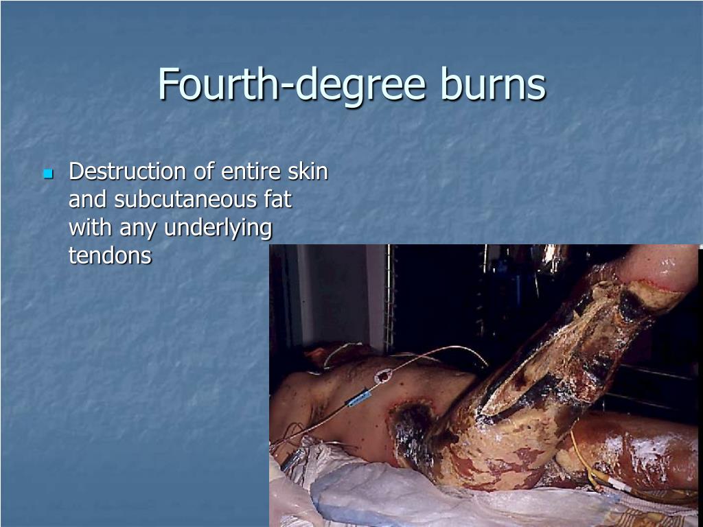 PPT Dermatoses Resulting from Physical Factors