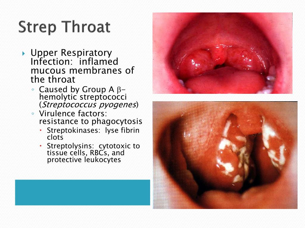 PPT Diseases of the Respiratory System PowerPoint