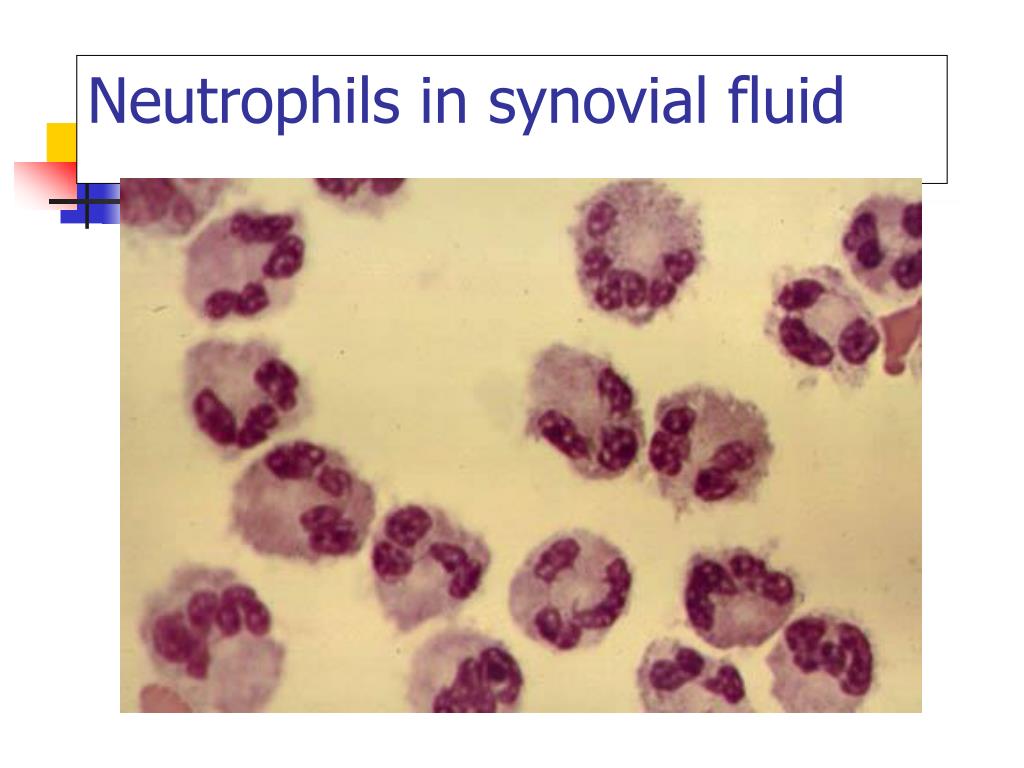 PPT Synovial Fluid PowerPoint Presentation, free download ID702385