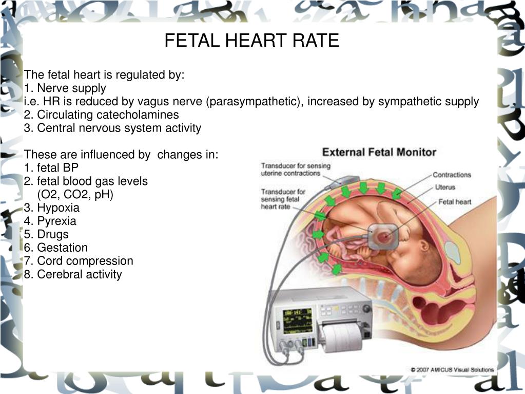 PPT FETAL MONITORING PowerPoint Presentation, free download ID704419