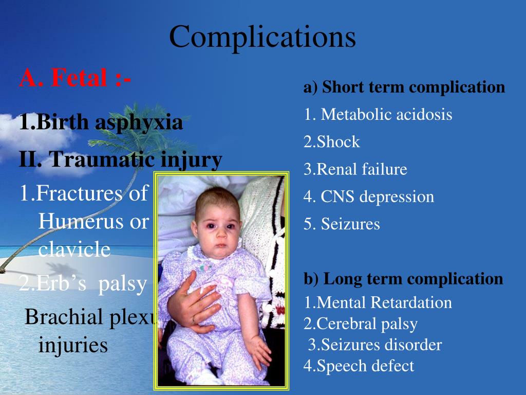 PPT Shoulder dystocia PowerPoint Presentation, free download ID709349