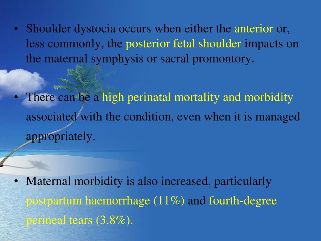 PPT Shoulder dystocia PowerPoint Presentation ID709349