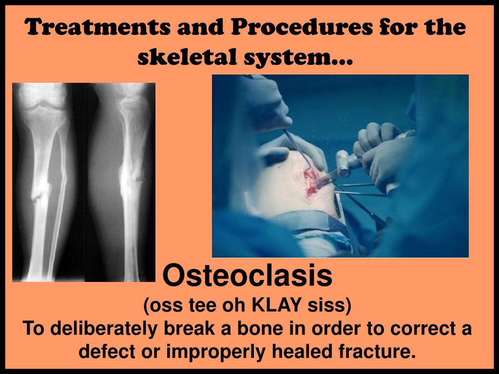 PPT Medical terminology PowerPoint Presentation, free download ID