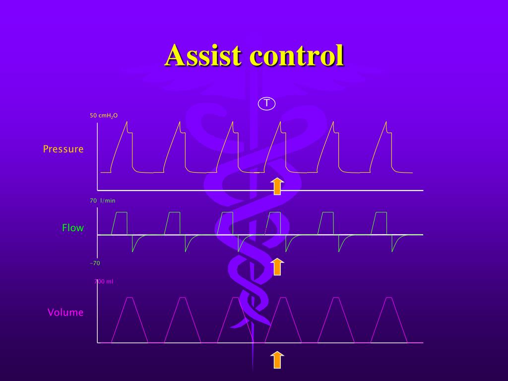 PPT How To Ventilate ICU Patient PowerPoint Presentation, free