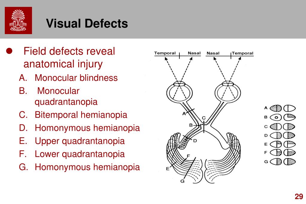 PPT Chapter 3 CNS Gross Anatomy PowerPoint Presentation, free