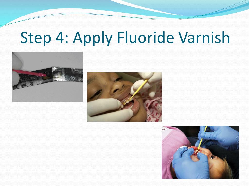 PPT How to Apply Fluoride Varnish PowerPoint Presentation, free