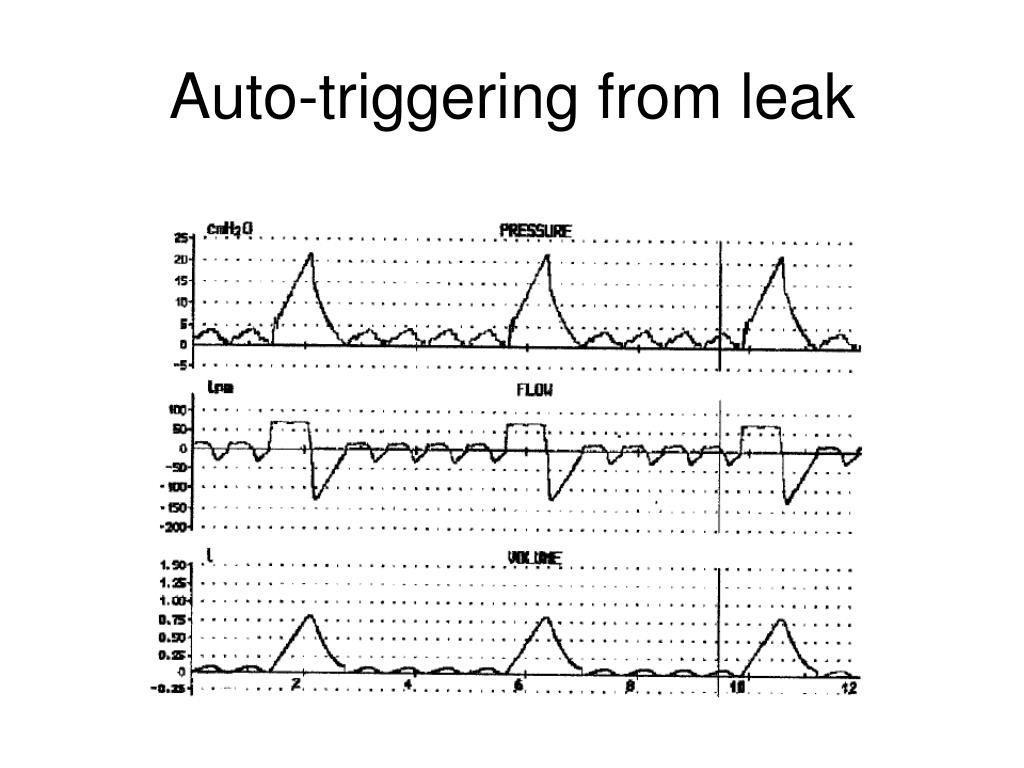 PPT Patientventilator interaction insight from waveforms PowerPoint
