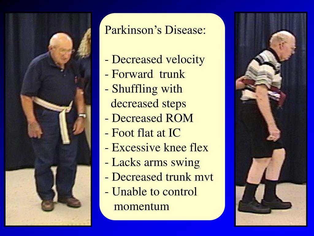 PPT Normal and Pathological Gait in the Elderly PowerPoint