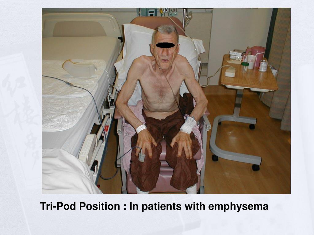 PPT Respiratory System Physical Examination PowerPoint Presentation