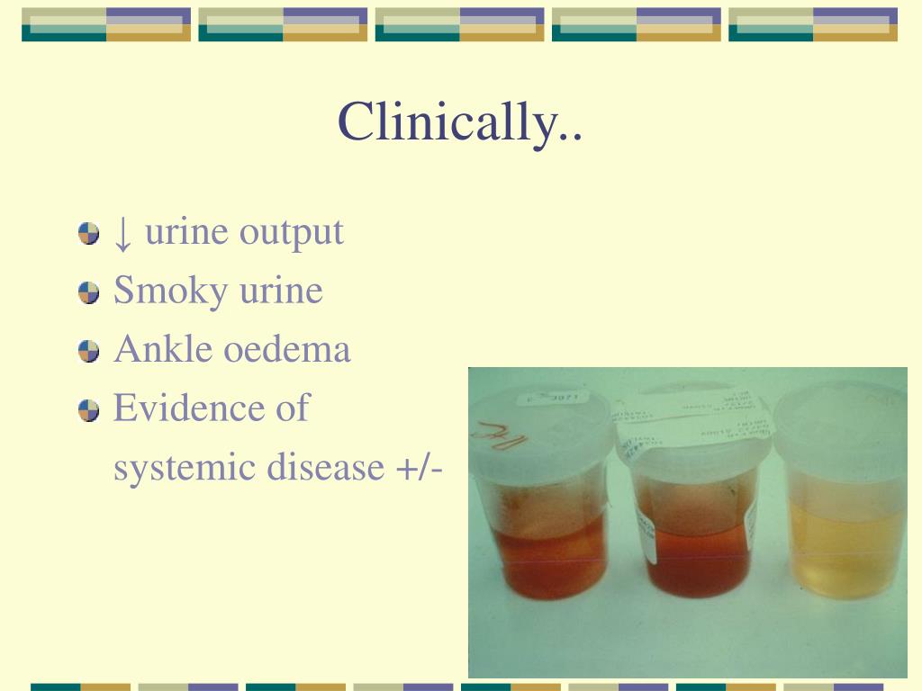 PPT Proteinuria in the Diagnosis & Management of Kidney Disease