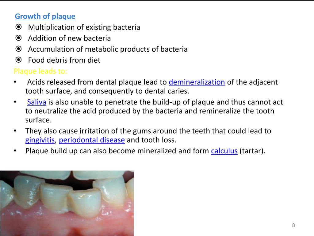 PPT DENTAL PLAQUE PowerPoint Presentation, free download ID734250