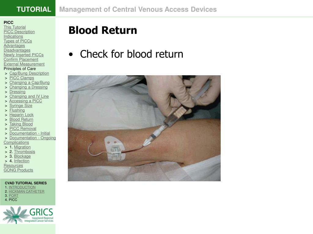 PPT 4. PERIPHERALLY INSERTED CENTRAL CATHETER PICC