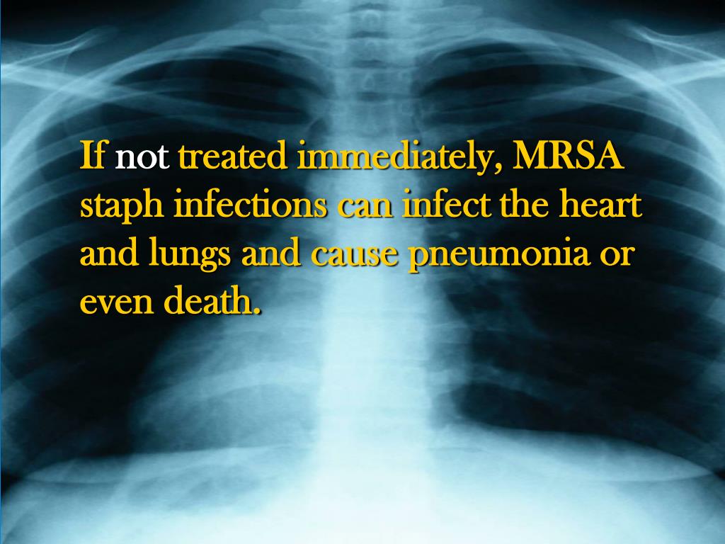 PPT MRSA STAPH INFECTIONS Donald L. Trussell Office of Safety / Loss