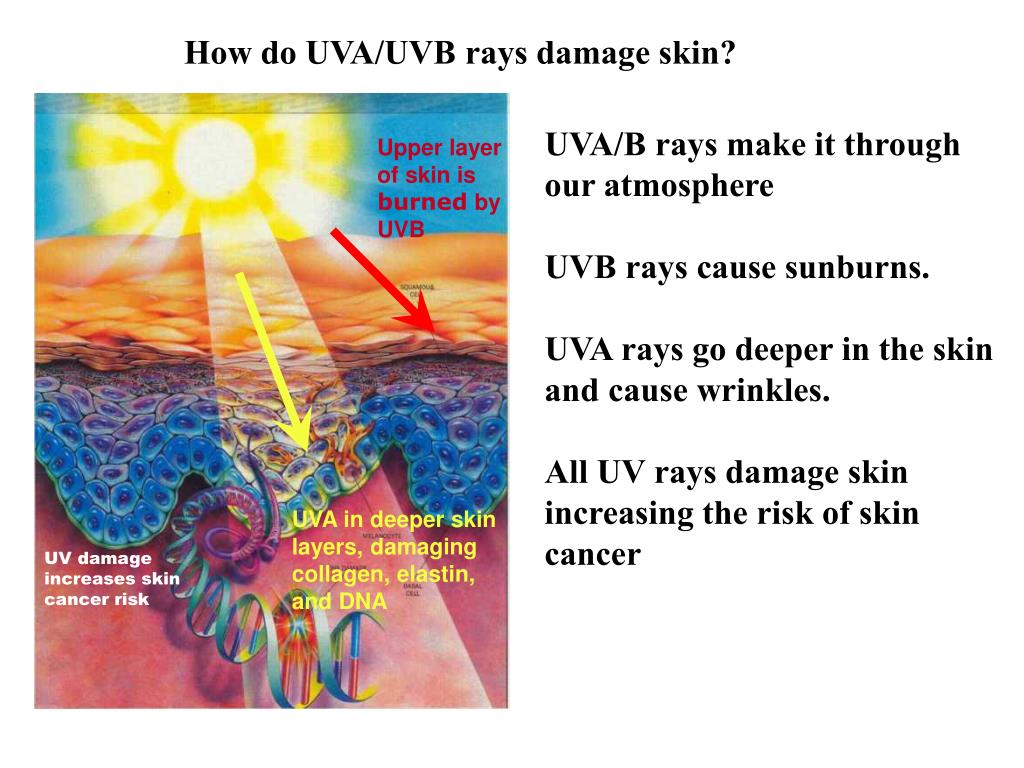 PPT How do UVA/UVB rays damage skin? PowerPoint Presentation, free