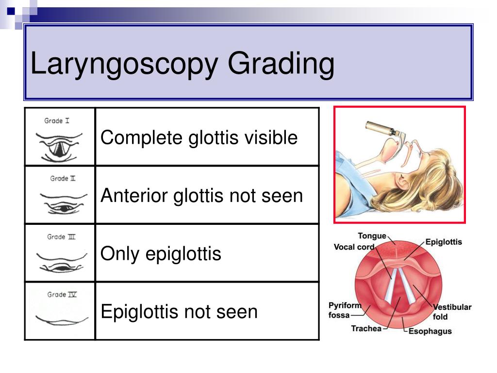 Airway Grading