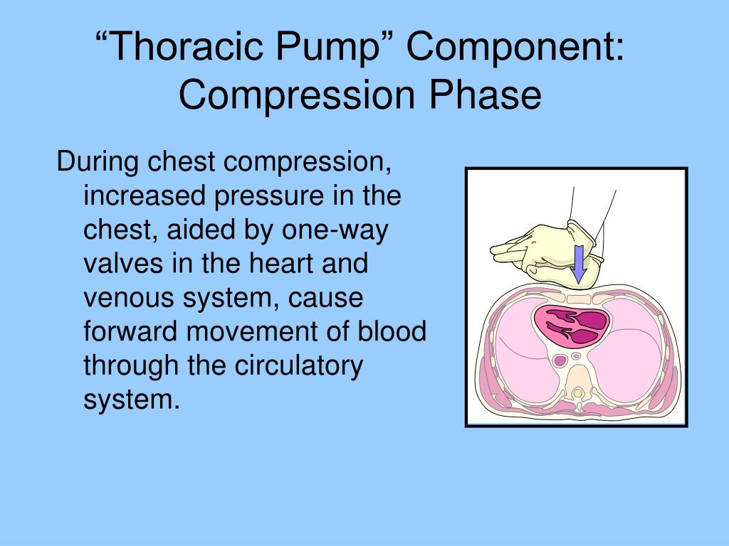 PPT Adult CPR and the ResQ Trial PowerPoint Presentation, free download ID749948