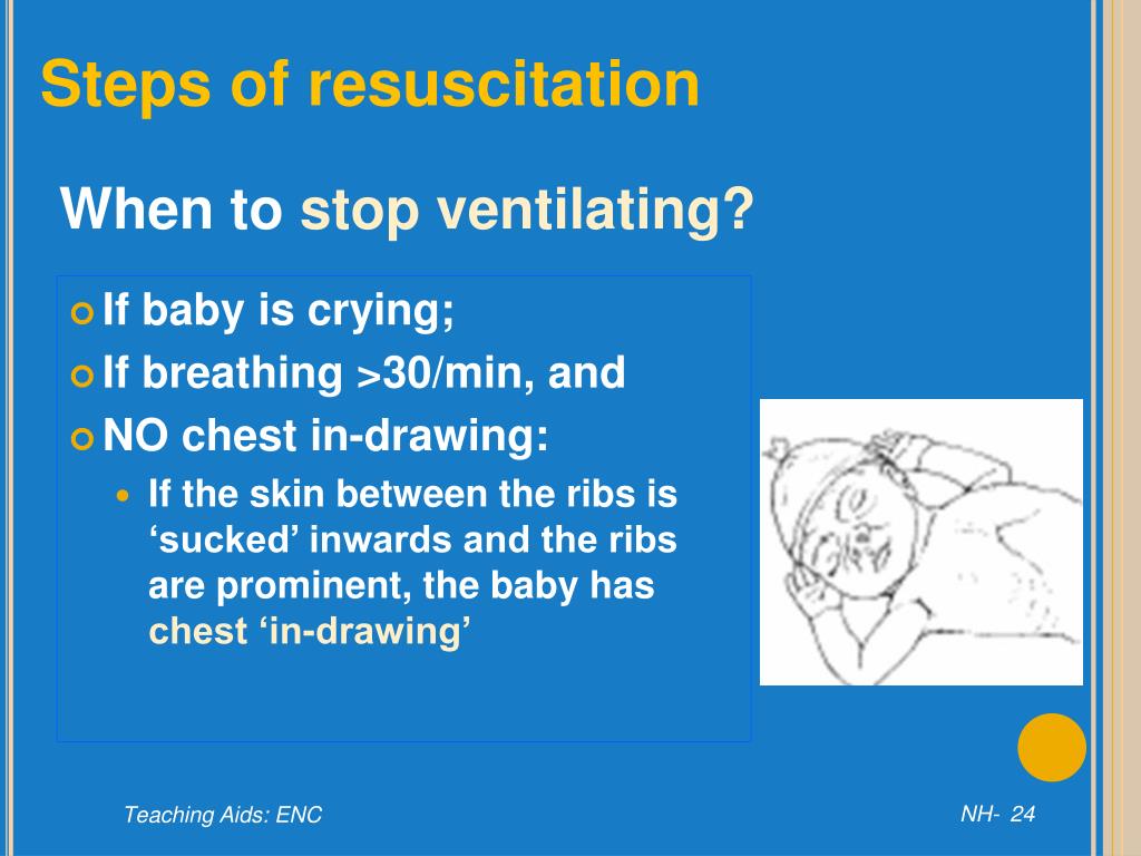 PPT Resuscitation of the newborn baby PowerPoint Presentation, free