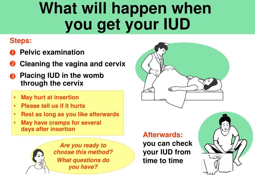 PPT Very effective, with little to remember. Copper T 380A lasts for