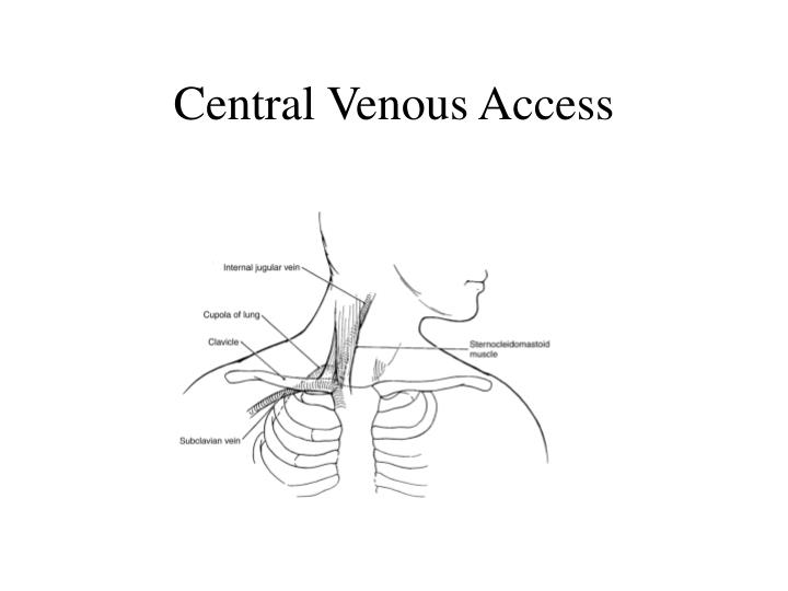 Central Venous Access Central Venous Access Atlanta Vascular & Vein