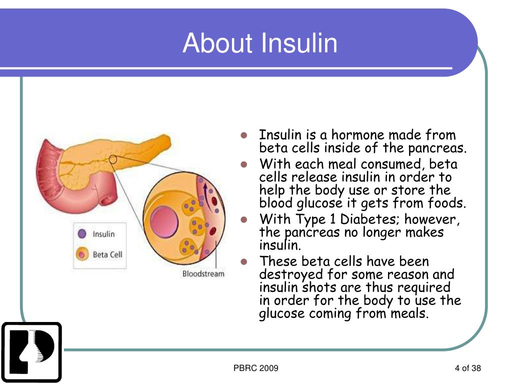 PPT Type 1 Diabetes PowerPoint Presentation, free download ID75964